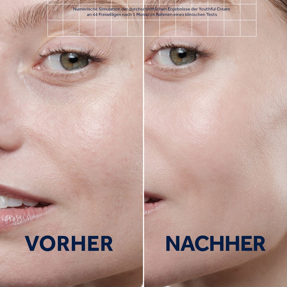 Vorher-Nachher-Vergleich. Gesichtshälften. Links: Vorher. Rechts: Nachher. Text: Youthful Cream.