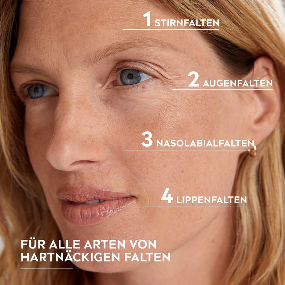 Gesicht einer Frau mit Markierungen für Stirn-, Augen-, Nasolabial- und Lippenfalten.