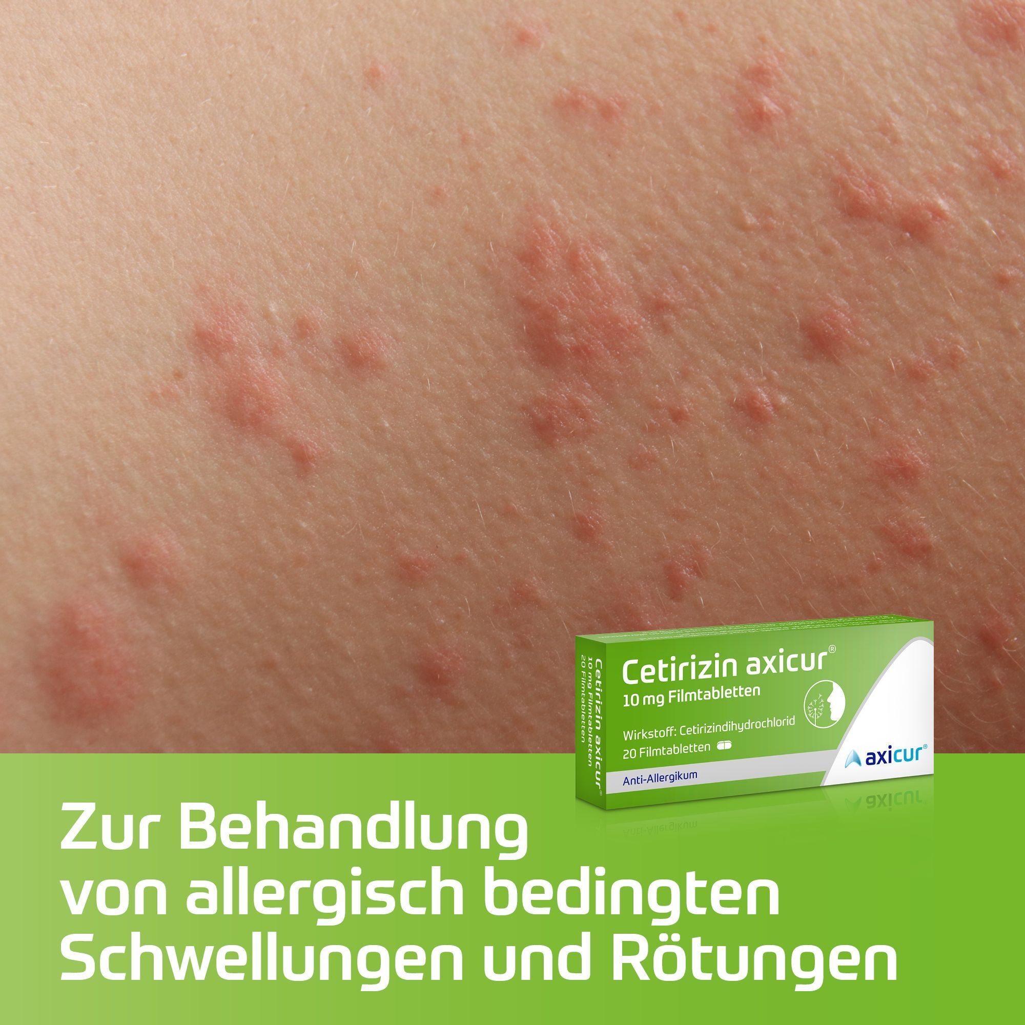 Haut mit allergischen Reaktionen. Unten: grüne Schachtel "Cetirizin axicur®". Text: "Zur Behandlung von allergisch bedingten Schwellungen und Rötungen".