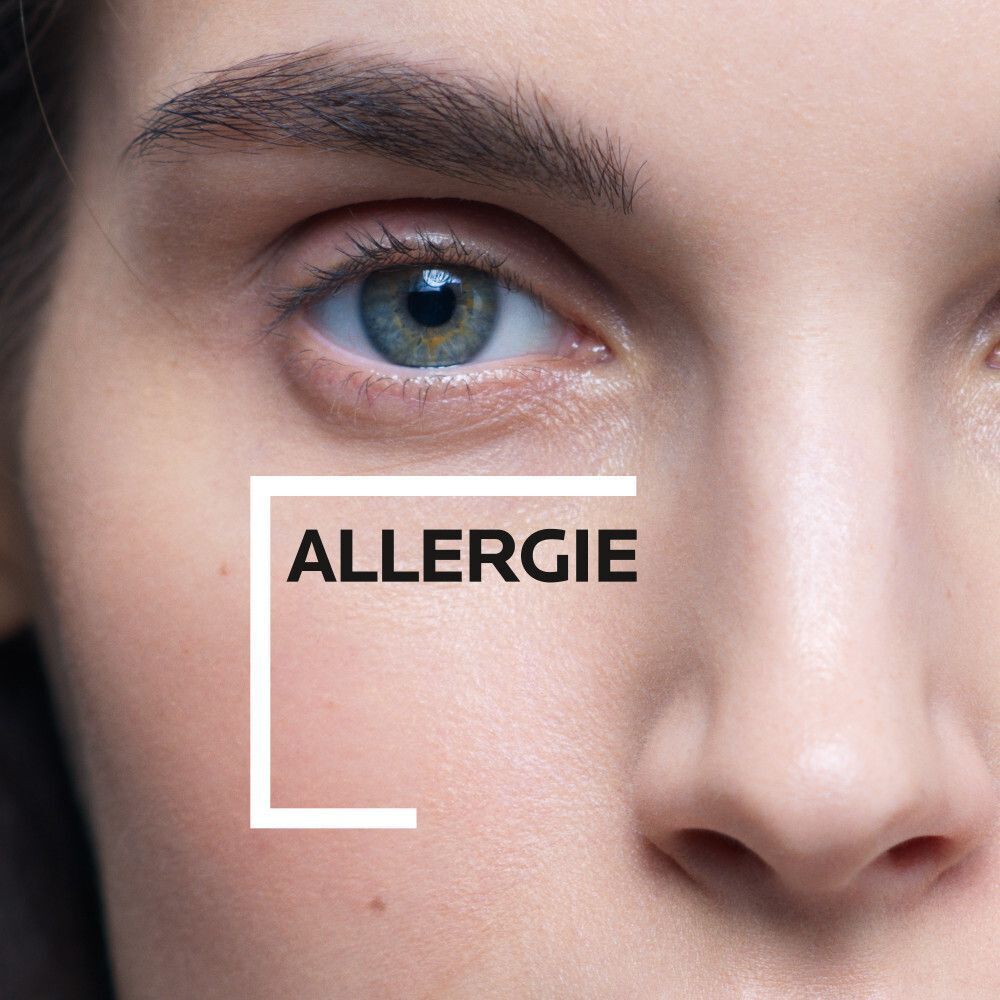 Nahaufnahme eines Auges. Text: Allergie, in einem weißen Rahmen.
