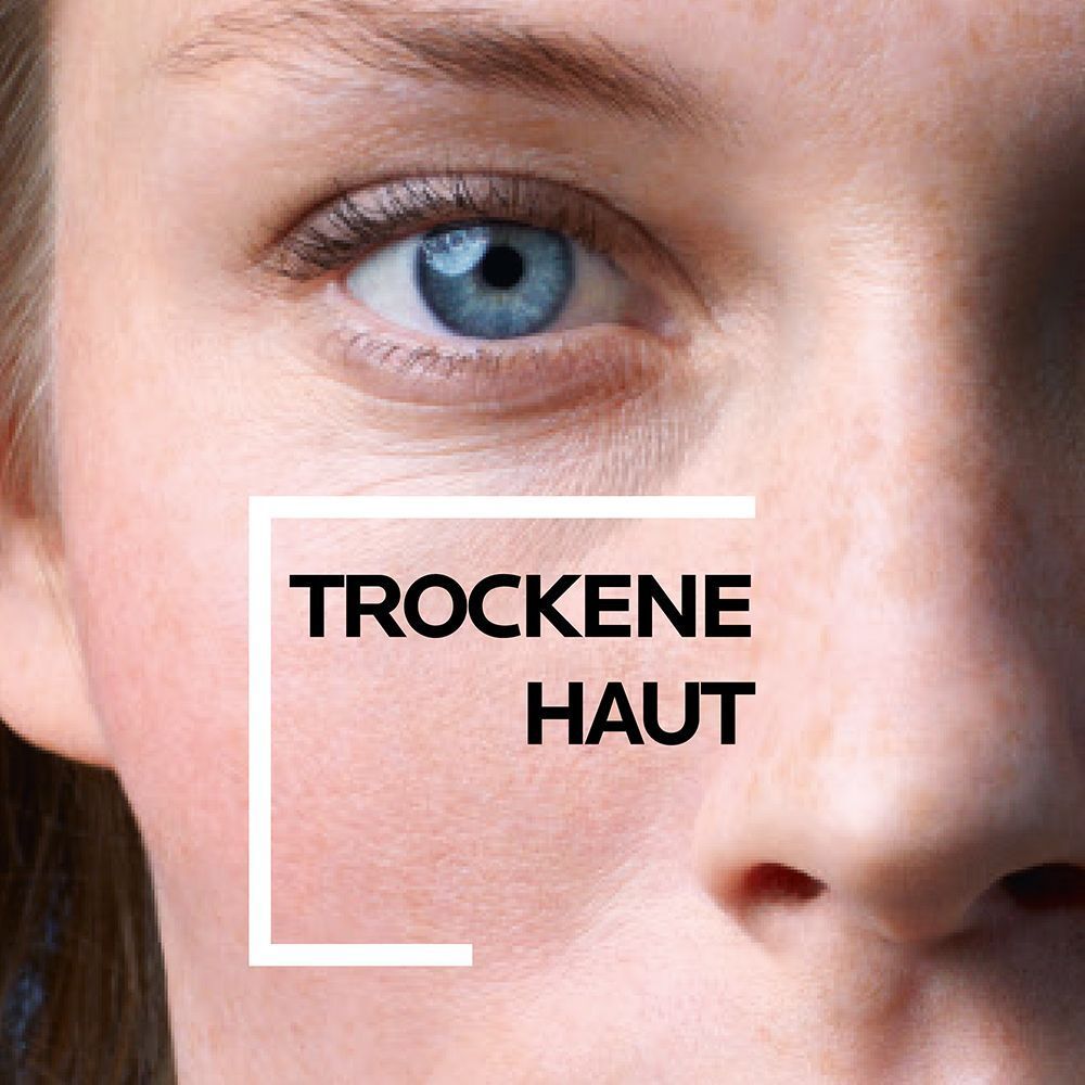 Nahaufnahme eines Gesichts. Text: Trockene Haut.