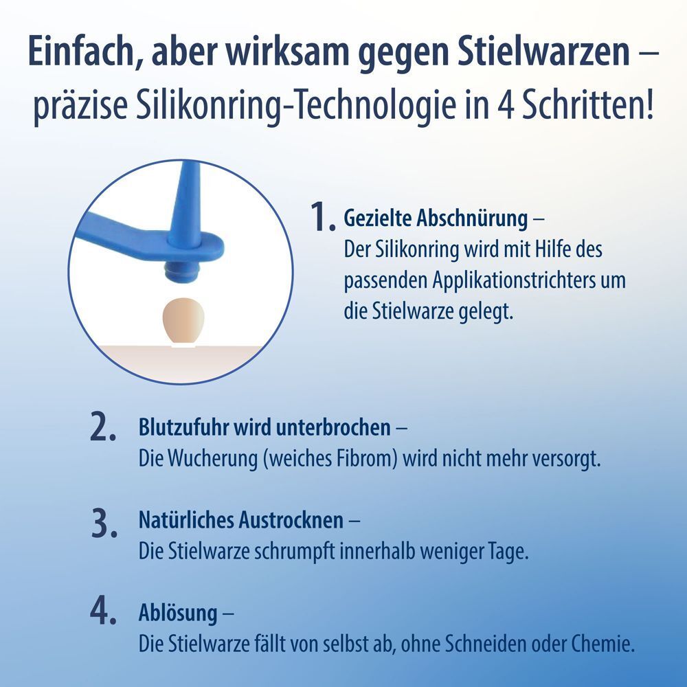 Illustration der Anwendung von Evolsin Anti Stielwarze. Vier Schritte: Abschnüren, Unterbrechen, Austrocknen, Ablösen.