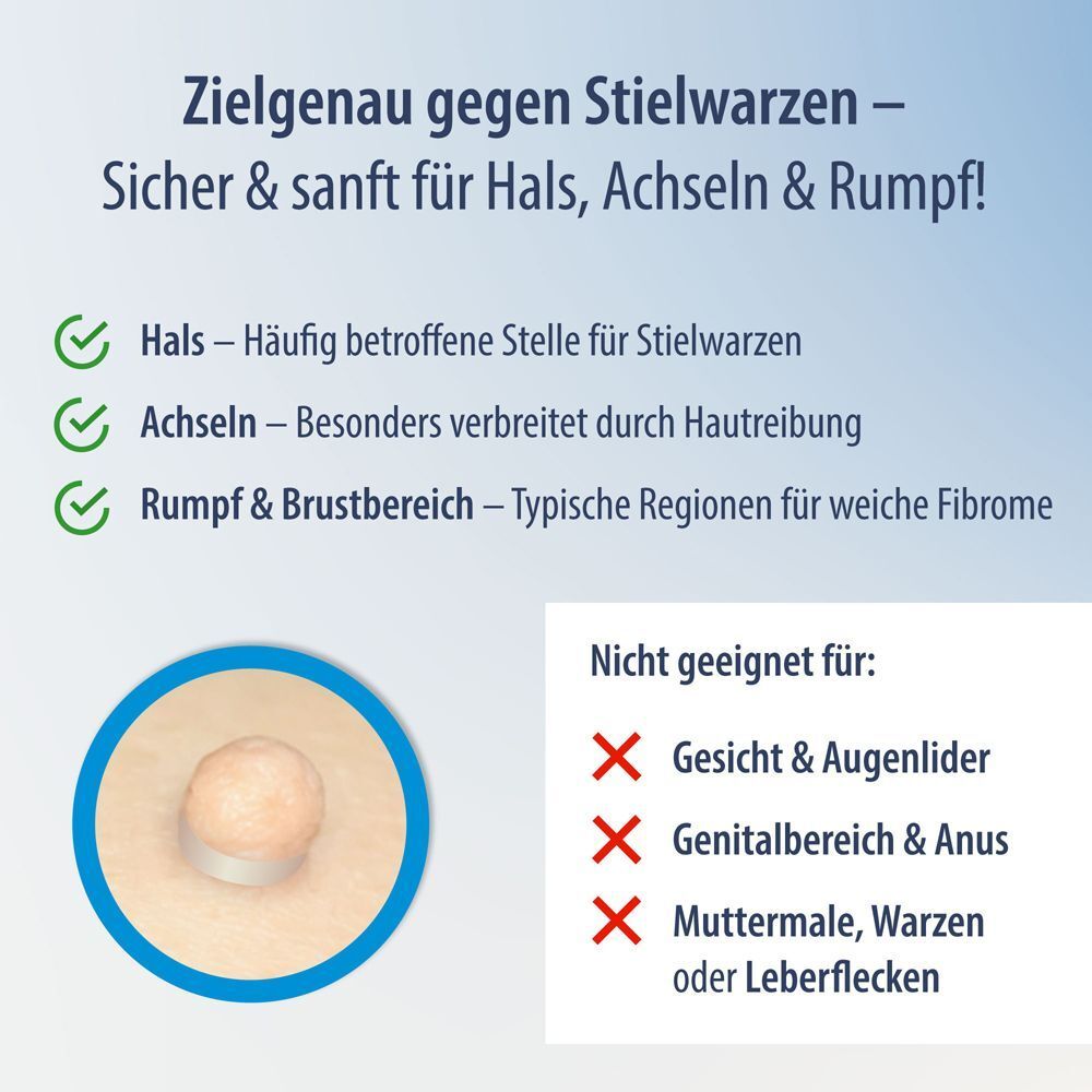 Evolsin Anti Stielwarze: Geeignet für Hals, Achseln & Rumpf. Nicht geeignet für Gesicht, Genitalbereich, Muttermale.