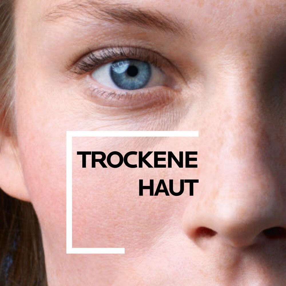 Nahaufnahme eines Gesichts mit dem Text "Trockene Haut" in einem weißen Rahmen.