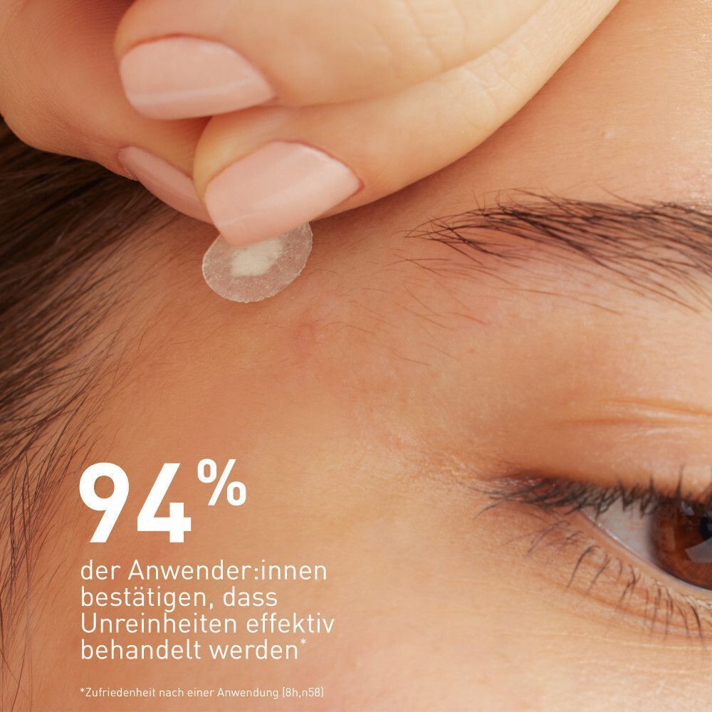 Ein Patch wird auf eine Hautpartie geklebt. Darunter steht: 94% der Anwender:innen bestätigen, dass Unreinheiten effektiv behandelt werden.