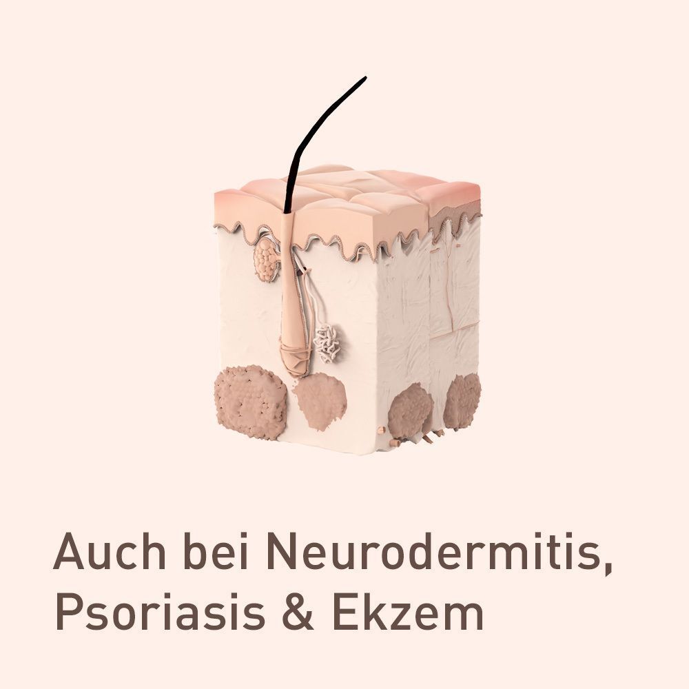 Modell einer Hautschicht mit Haar. Text: Auch bei Neurodermitis, Psoriasis & Ekzem.