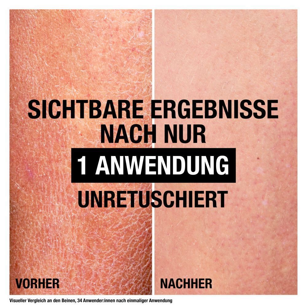 Vergleich Vorher/Nachher. Trockene Haut auf Beinen. Nach 1 Anwendung: sichtbar verbesserte Haut. Text: Sichtbare Ergebnisse nach nur 1 Anwendung.