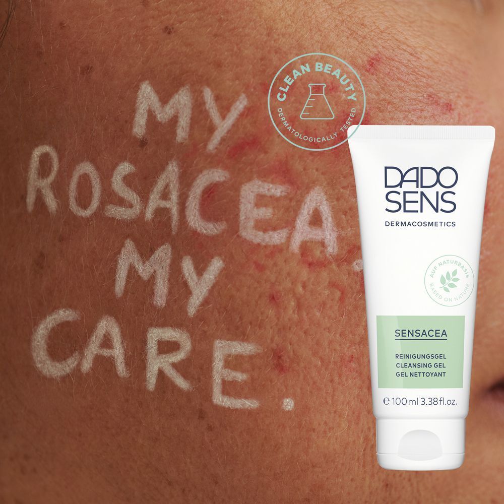 Hautpartie mit Rötungen und der Aufschrift 'MY ROSACEA MY CARE'. Daneben eine Tube DADO SENS SENSACEA Reinigungsgel.