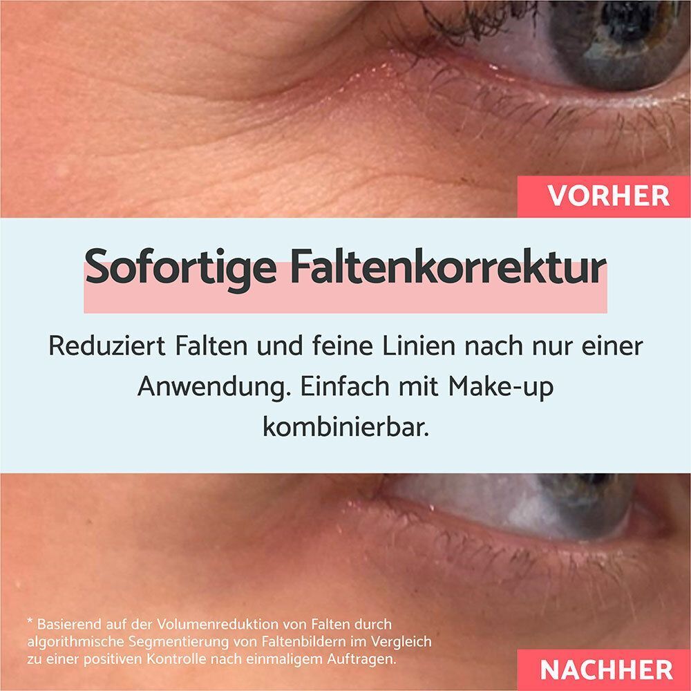 Vergleich Vorher/Nachher. Augenpartie mit Falten vor und nach der Anwendung des Produkts.