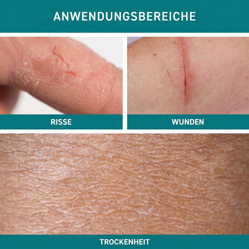 Nahaufnahme von Hautrissen, einer Wunde und trockener Haut.