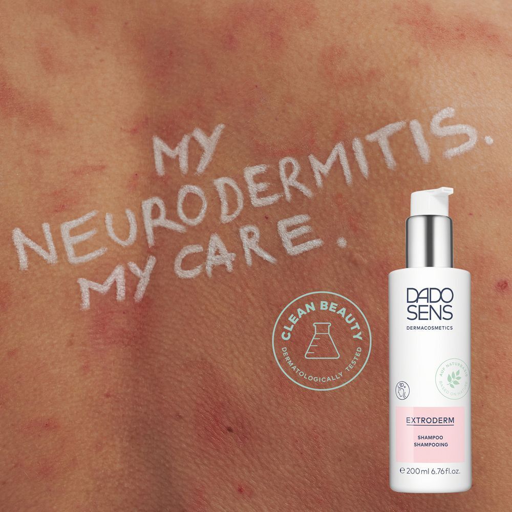 Haut mit roten Flecken und weißer Schrift 'MY NEURODERMITIS. MY CARE.' daneben eine DADO SENS Flasche.