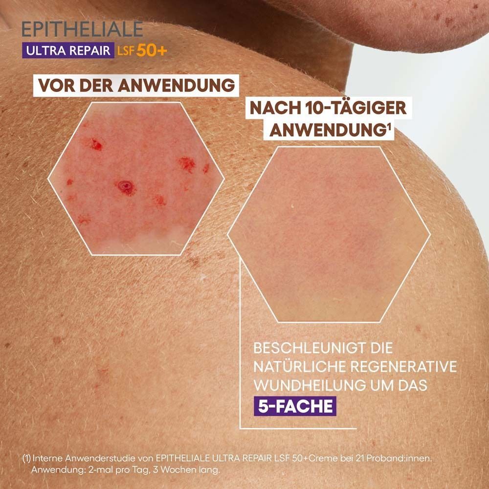 Hautausschnitt mit Vergleich: Vor der Anwendung und nach 10-tägiger Anwendung. Text: Beschleunigt die Wundheilung.
