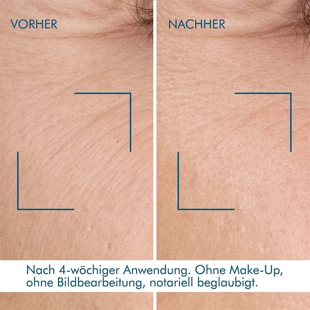 Vorher-Nachher-Vergleich von Haut. Text: Nach 4-wöchiger Anwendung. Ohne Make-Up, ohne Bildbearbeitung.