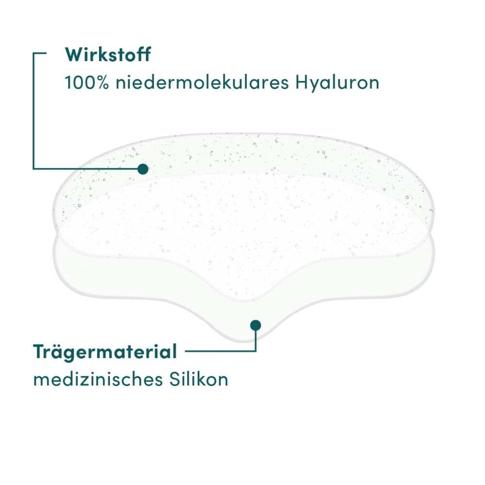 Querschnitt durch ein Stirn Pad. Zeigt Wirkstoff (100% Hyaluron) und Trägermaterial (medizinisches Silikon).