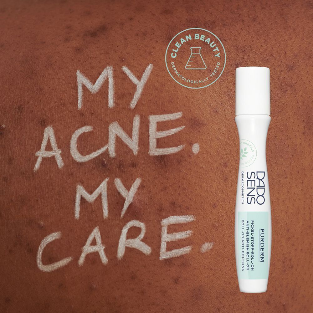 Haut mit Akne und DADO SENS PURDERM Pickel-Stopp Roll-on.