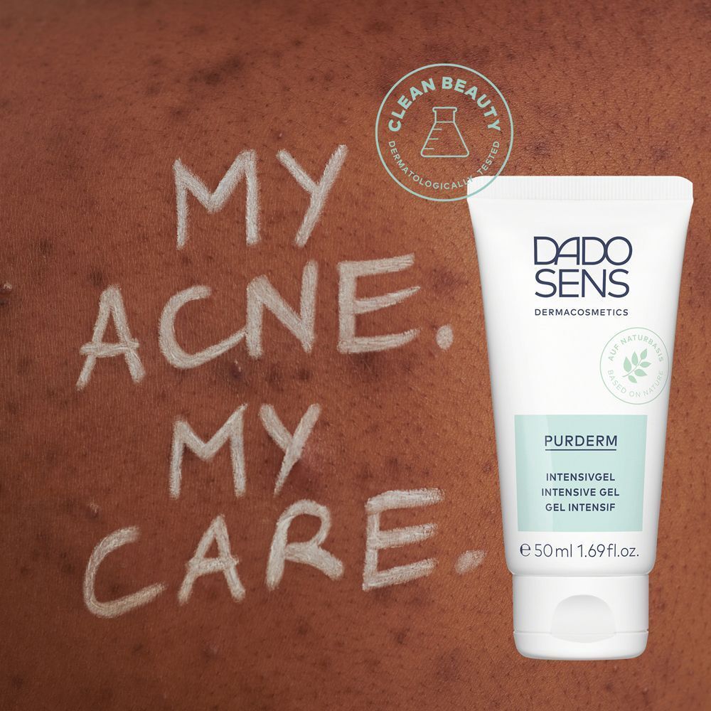 Haut mit Akne, daneben eine Tube DADO SENS PURDERM Intensivgel.