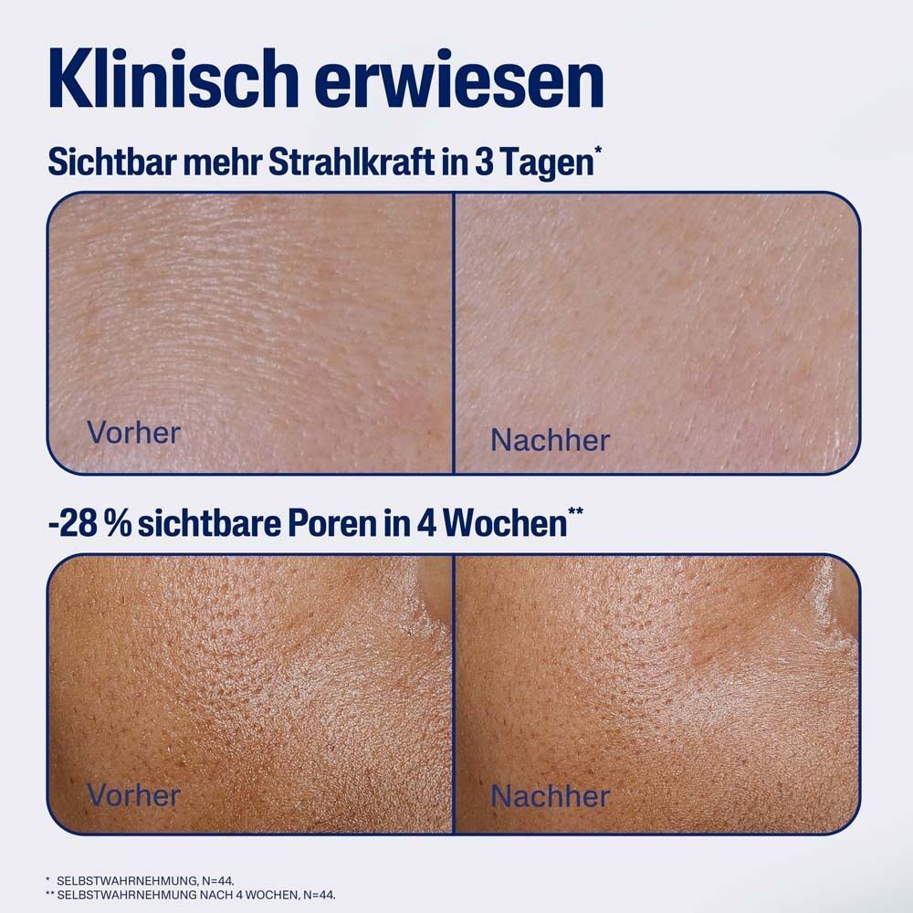 Vorher-Nachher-Vergleich der Hauttextur und Poren nach Anwendung des Serums.