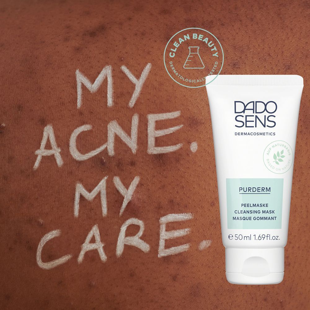 DADO SENS PURDERM Peelingmaske neben der Aufschrift 'MY ACNE. MY CARE.'