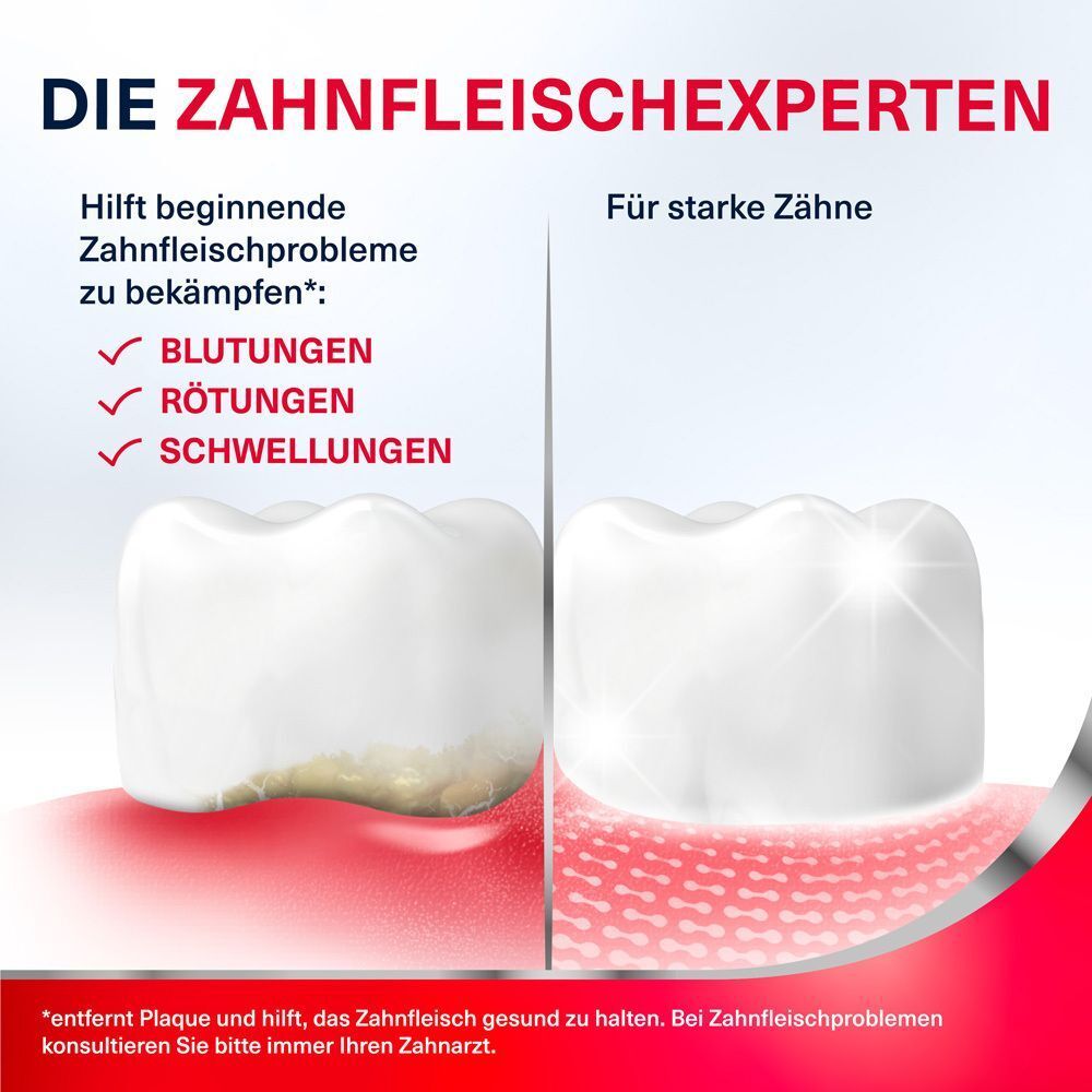 Zähne mit Zahnfleisch. Text: 'Die Zahnfleischexperten'. Vergleich gesunder und kranker Zähne.