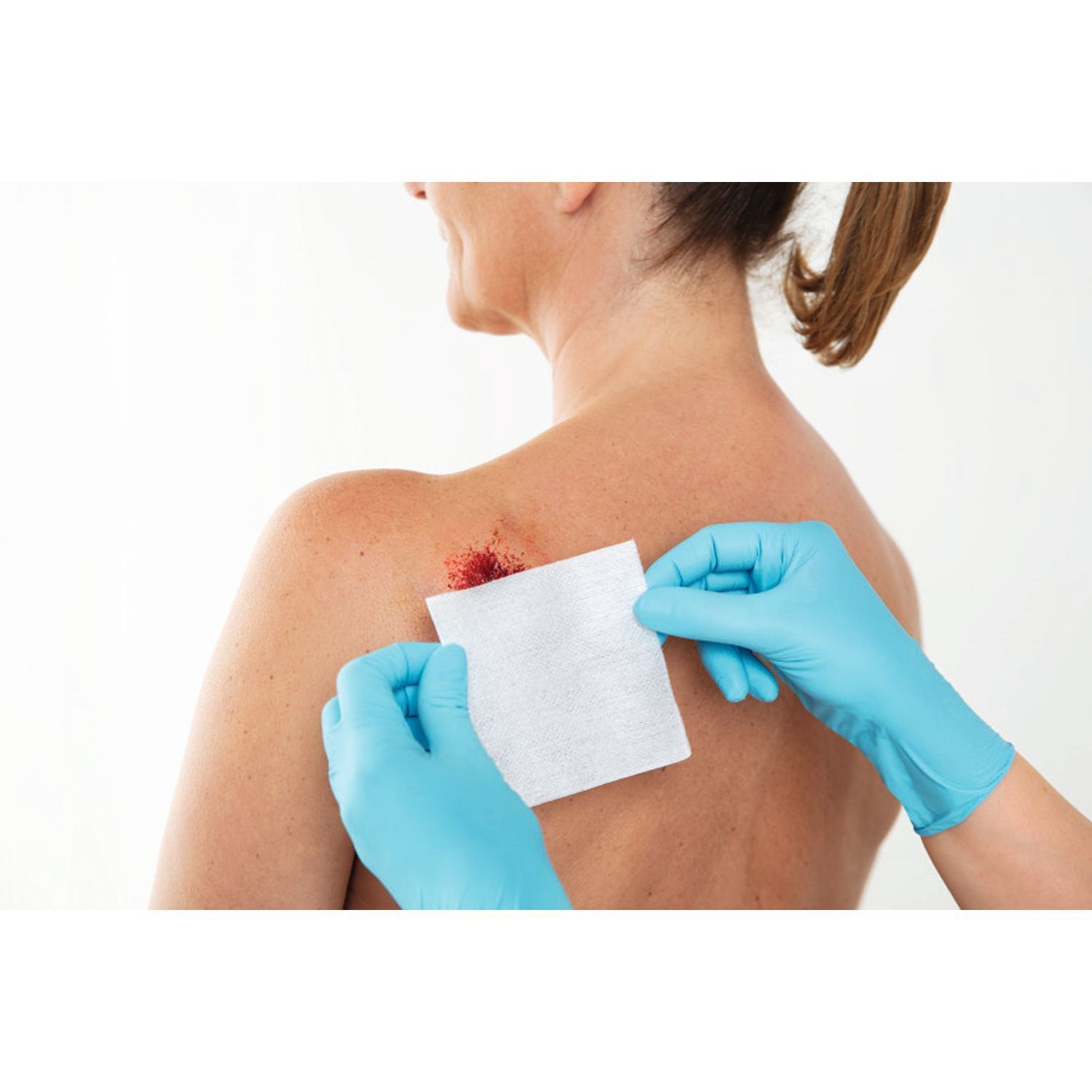 Person mit blauen Handschuhen legt Verband auf eine Wunde am Rücken. Der Verband ist weiß.