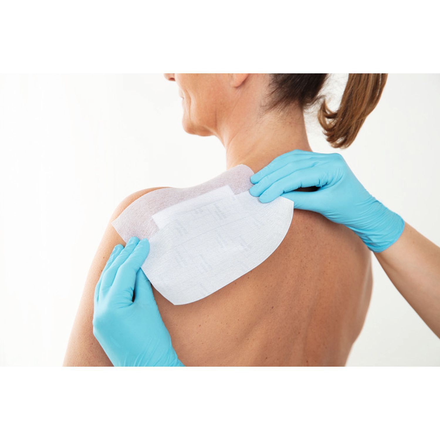 Person mit blauen Handschuhen bringt Verband auf dem Rücken an. Der Verband ist weiß und hat eine abgerundete Form.