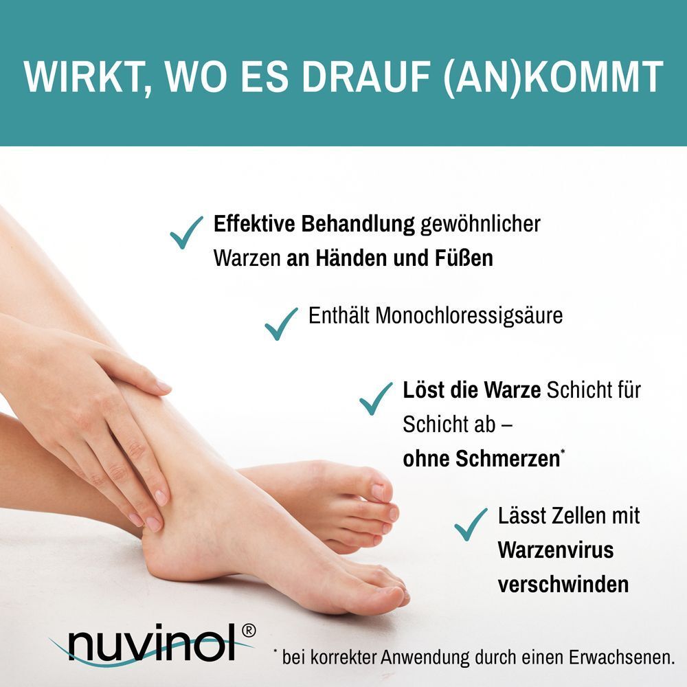 Nahaufnahme von Füßen, Nuvinol Warzenentferner Tinktur wirkt schmerzfrei.