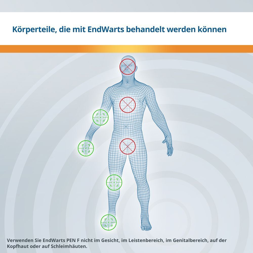 Infografik: Körperteile, die mit EndWarts behandelt werden können. Illustration eines Körpers mit Markierungen.