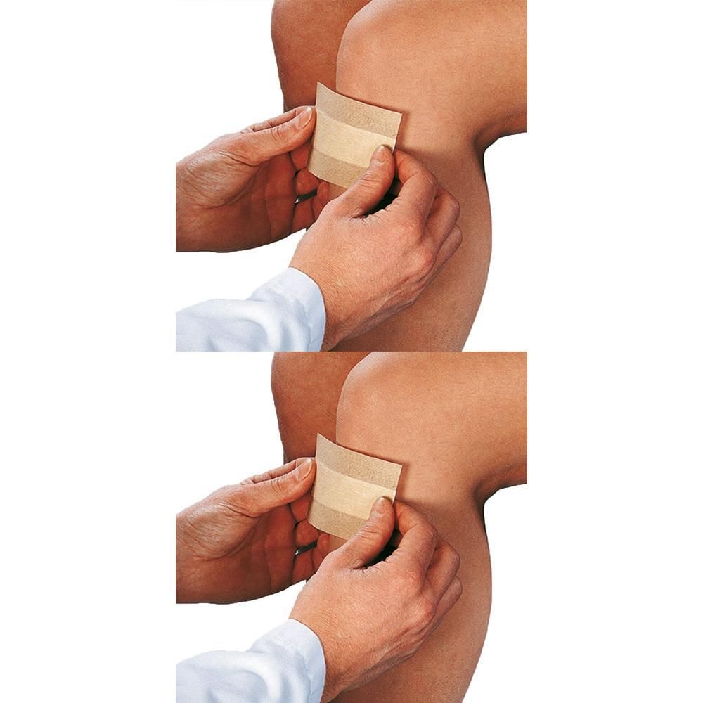 Curaplast Wundschnellverb.sensitiv 4x10 cm 1 m 2x 2x10 St Pflaster