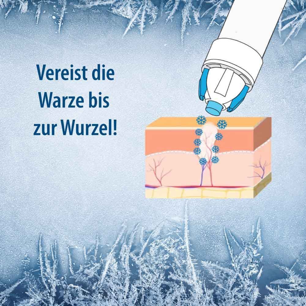Illustration: Vereist die Warze bis zur Wurzel! Darstellung einer Hautschicht mit Warze, die vereist wird.