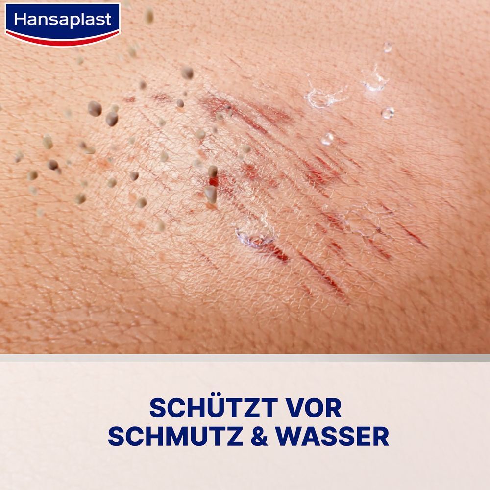 Nahaufnahme einer Hautwunde mit aufgetragenem, unsichtbarem Hansaplast Sprühpflaster.