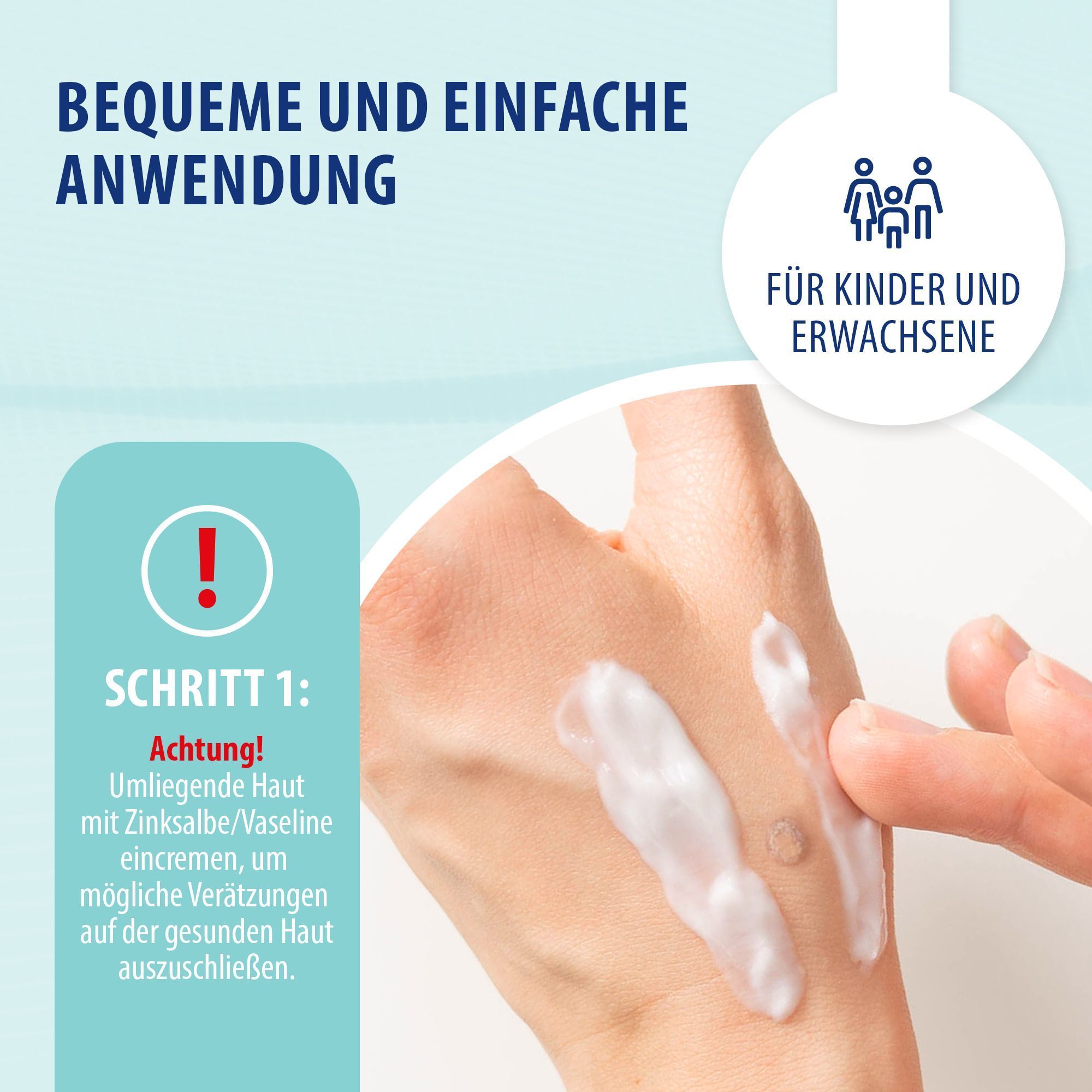 Illustration einer Hand, die eine Creme aufträgt. Text beschreibt Schritt 1 der Anwendung: Schutz der umliegenden Haut.