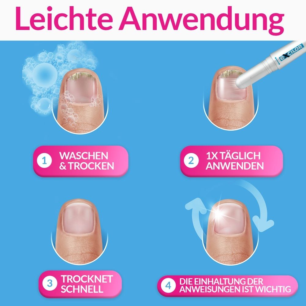 Excilor® Easy Behandlung von Nagelpilz