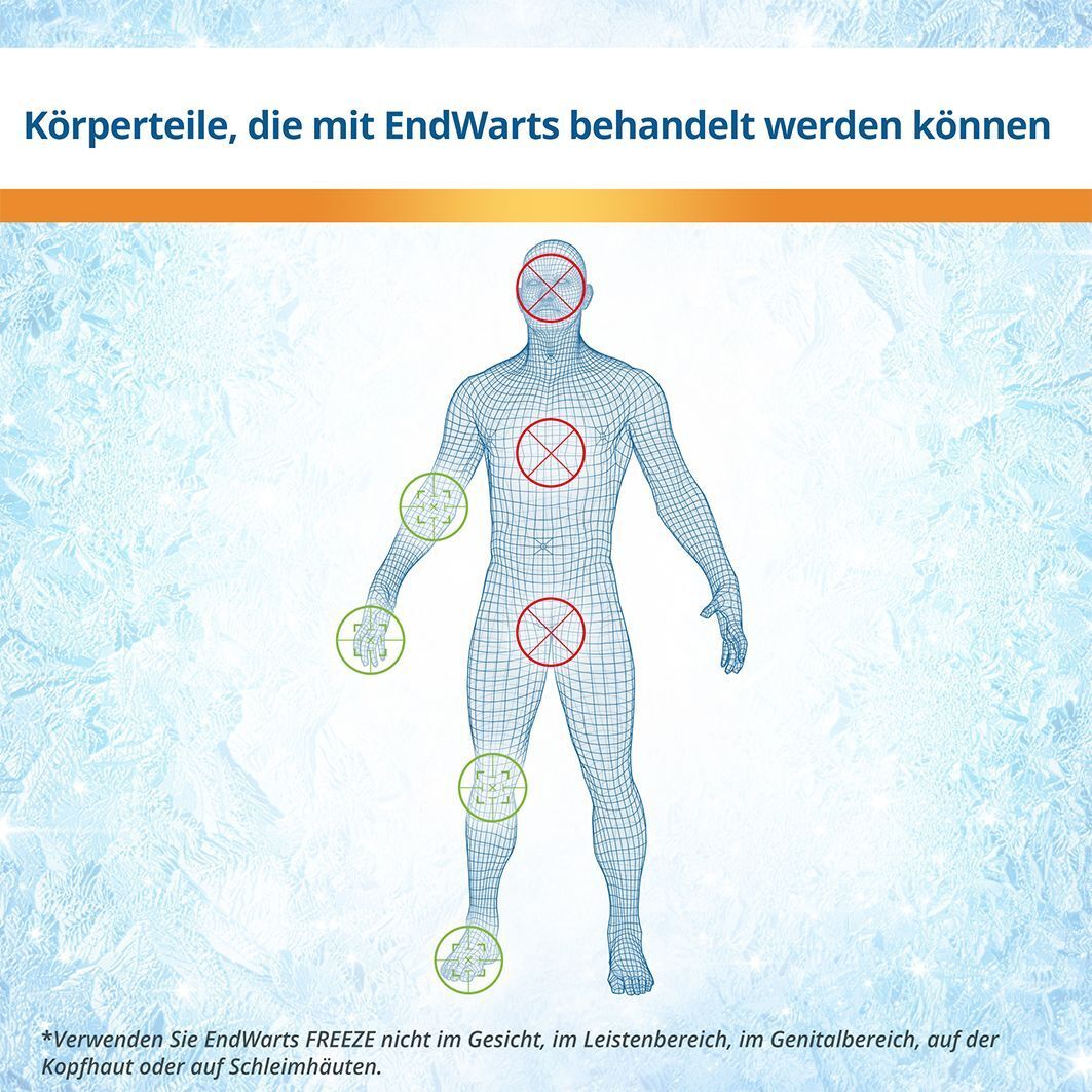 Menschliche Figur mit Markierungen. Rote Kreuze auf Gesicht, Leiste, Genitalbereich. Grüne Markierungen an Händen und Füßen.