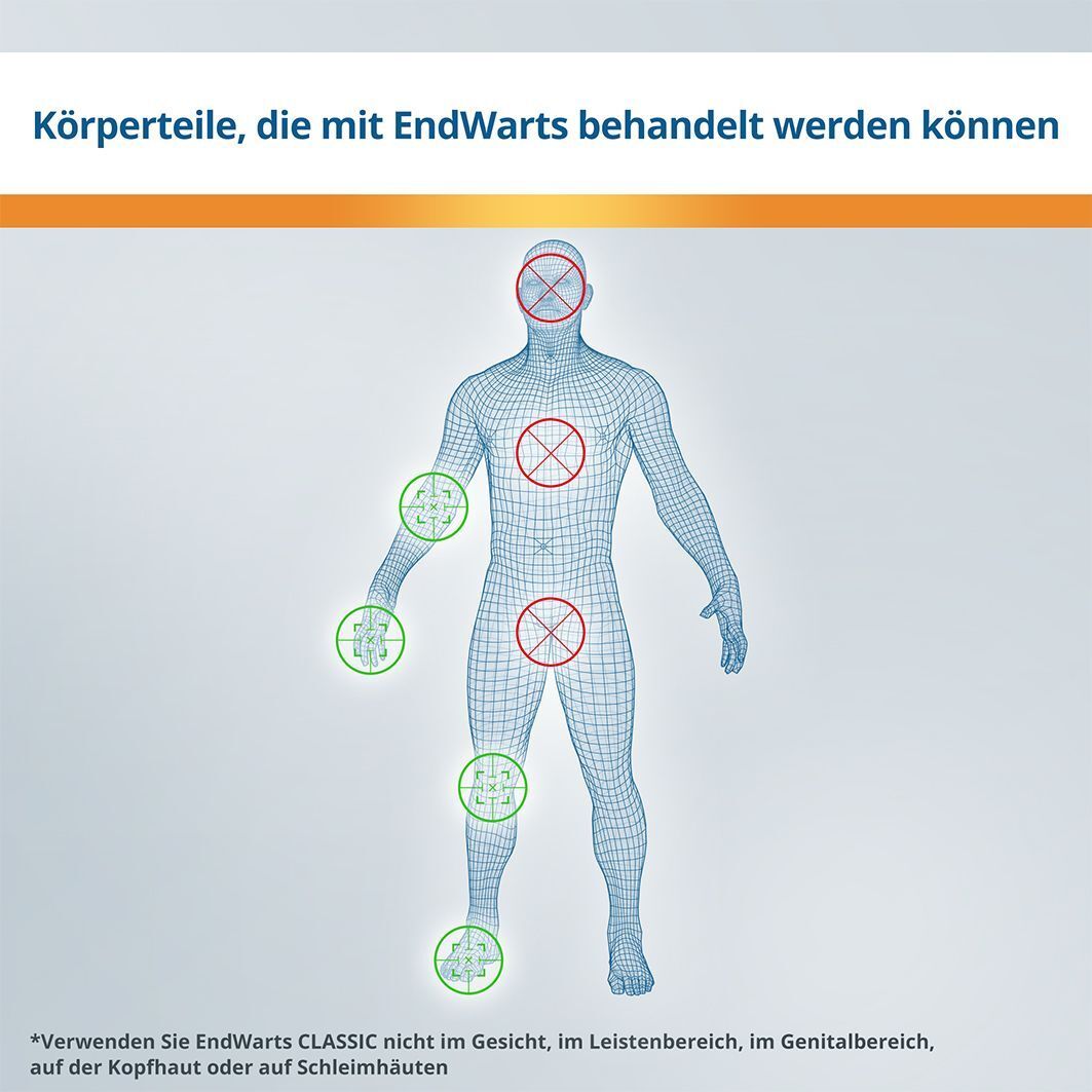 Körperteile, die mit EndWarts behandelt werden können. Grüne Kreuze: Hände, Füße. Rote Kreuze: Gesicht, Leiste, Genitalbereich.