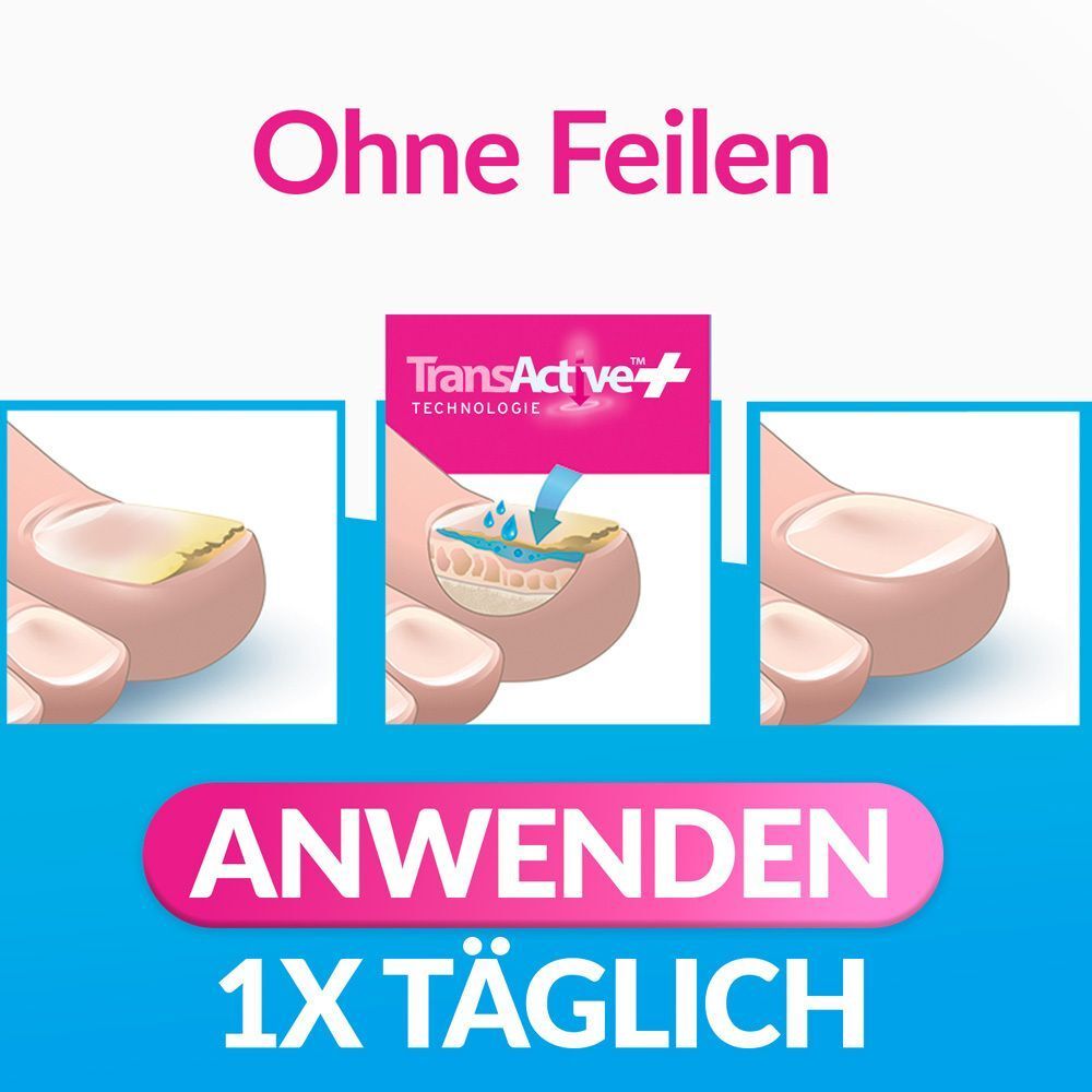 Anwendung excilor® INTENSIV. 1x täglich. Ohne Feilen. 3 Abbildungen: Anwendungsschritte. Text: TransActive Technologie.