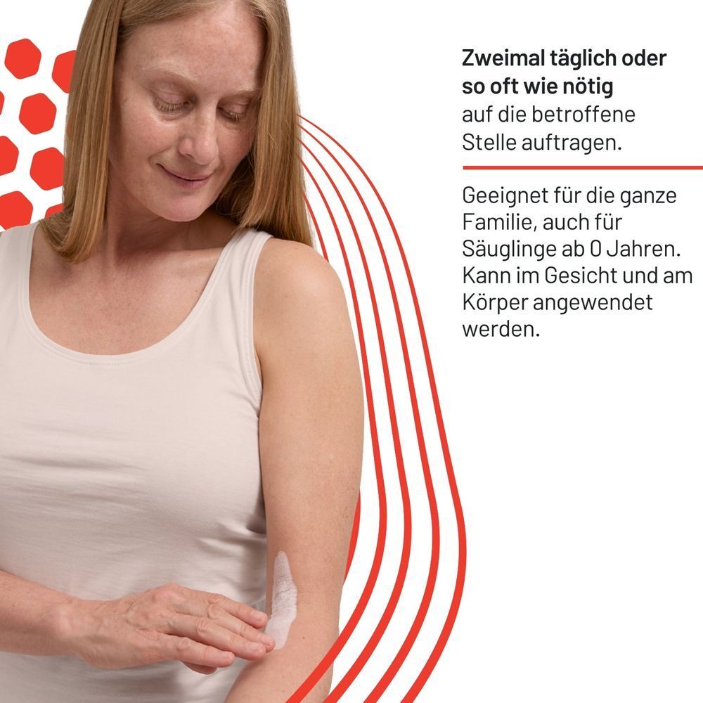 Frau trägt Locobase Ekzem Creme auf ihren Arm auf.