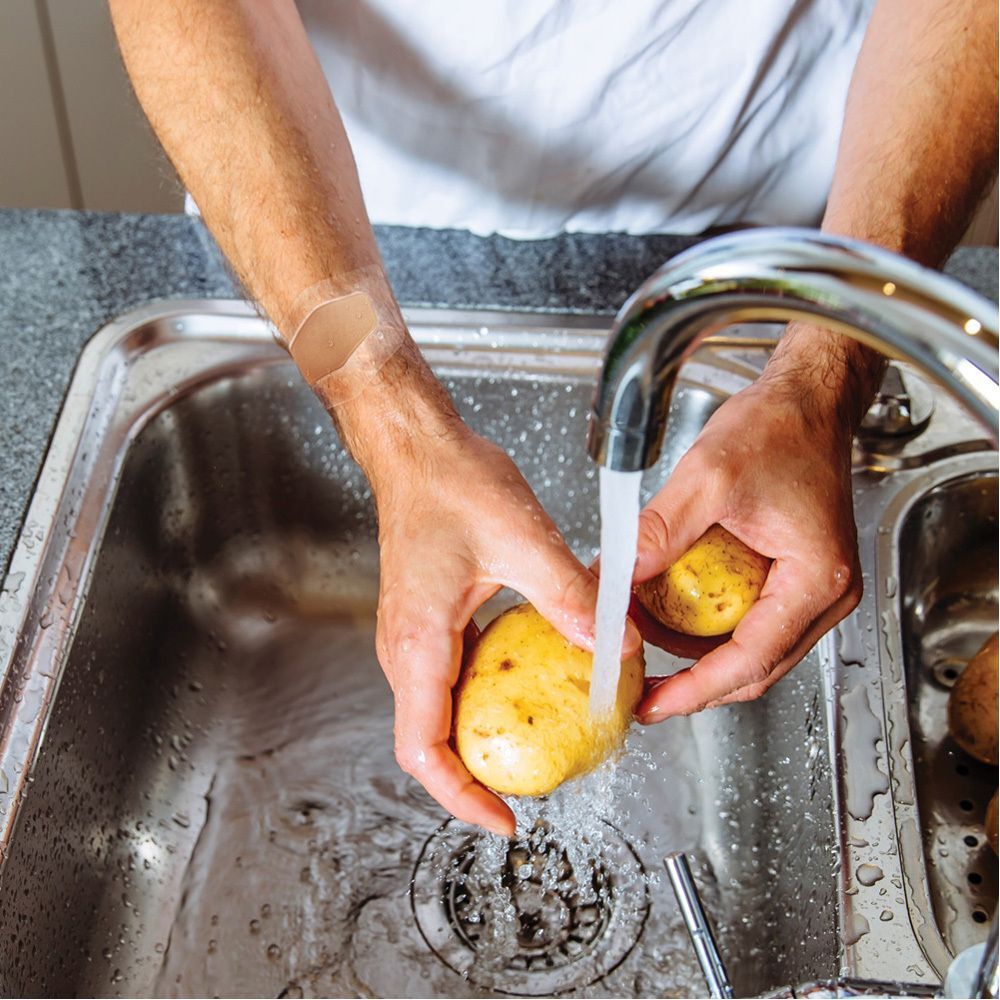 Hände waschen Kartoffeln in einem Waschbecken. Ein transparentes Pflaster am Handgelenk einer Person.