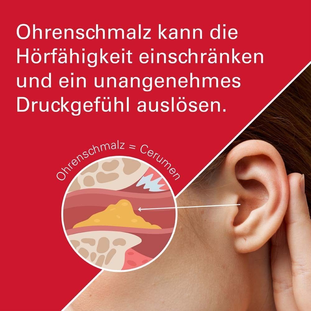 Illustration eines verstopften Ohres mit Ohrenschmalz neben einem menschlichen Ohr.