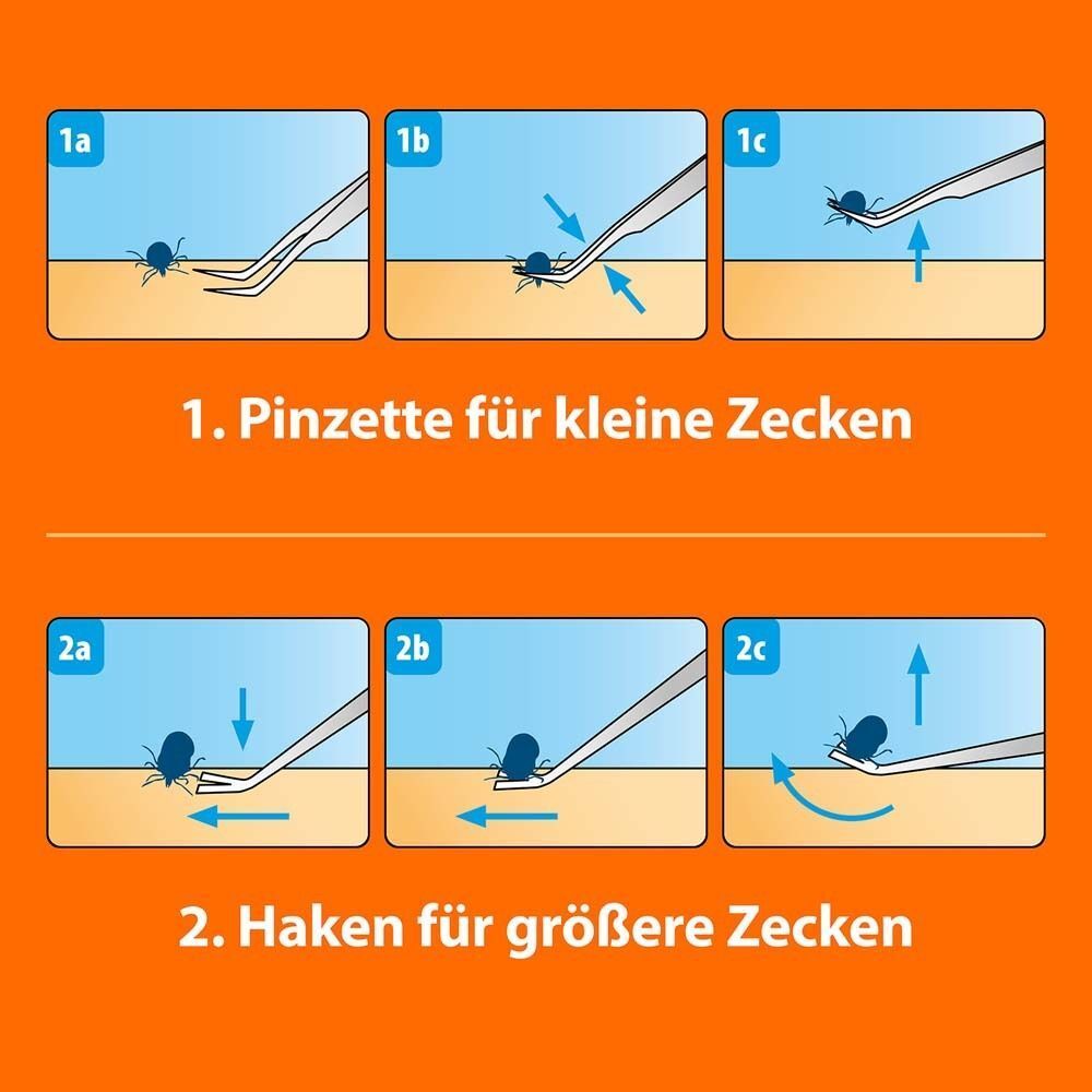 Illustrationen zur Anwendung von Pinzette und Haken zur Zeckenentfernung. Schritte 1a-1c: Pinzette. Schritte 2a-2c: Haken.