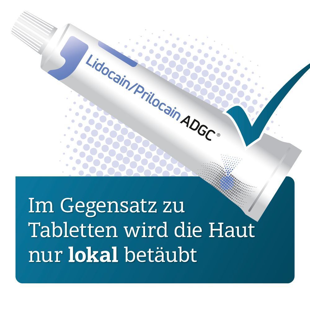 Tube Lidocain/Prilocain ADGC Creme mit Häkchen-Symbol.