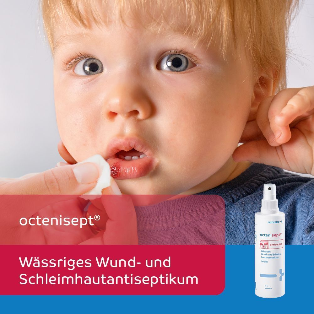 Kind mit aufgetragener Wundbehandlung, daneben octenisept® Antiseptikum.