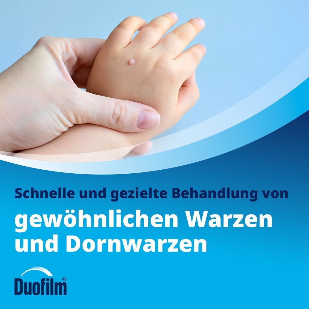 Kindshand mit Warze, behandelt mit Duofilm Lösung.