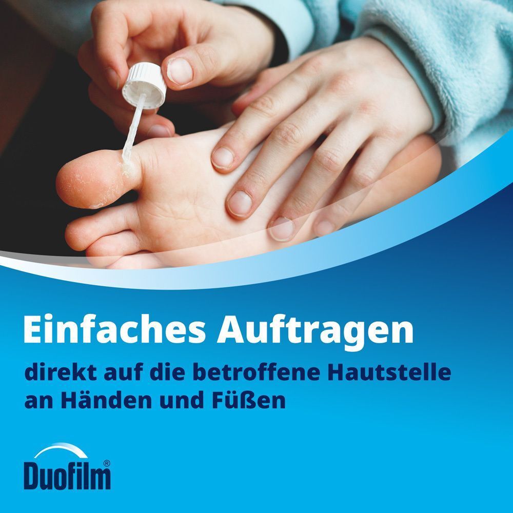 Auftragen von Duofilm Lösung auf eine Warze am Zeh.