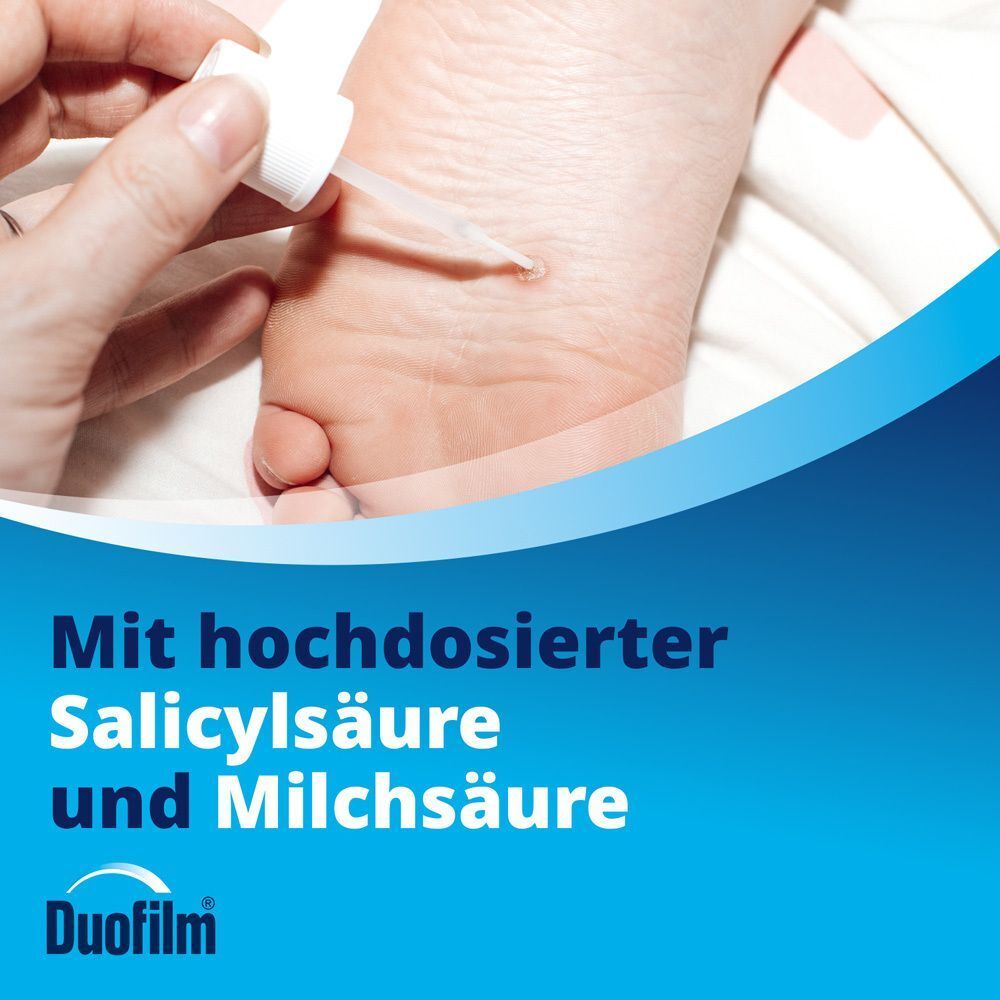 Detailansicht: Duofilm Lösung wird auf eine Warze aufgetragen.