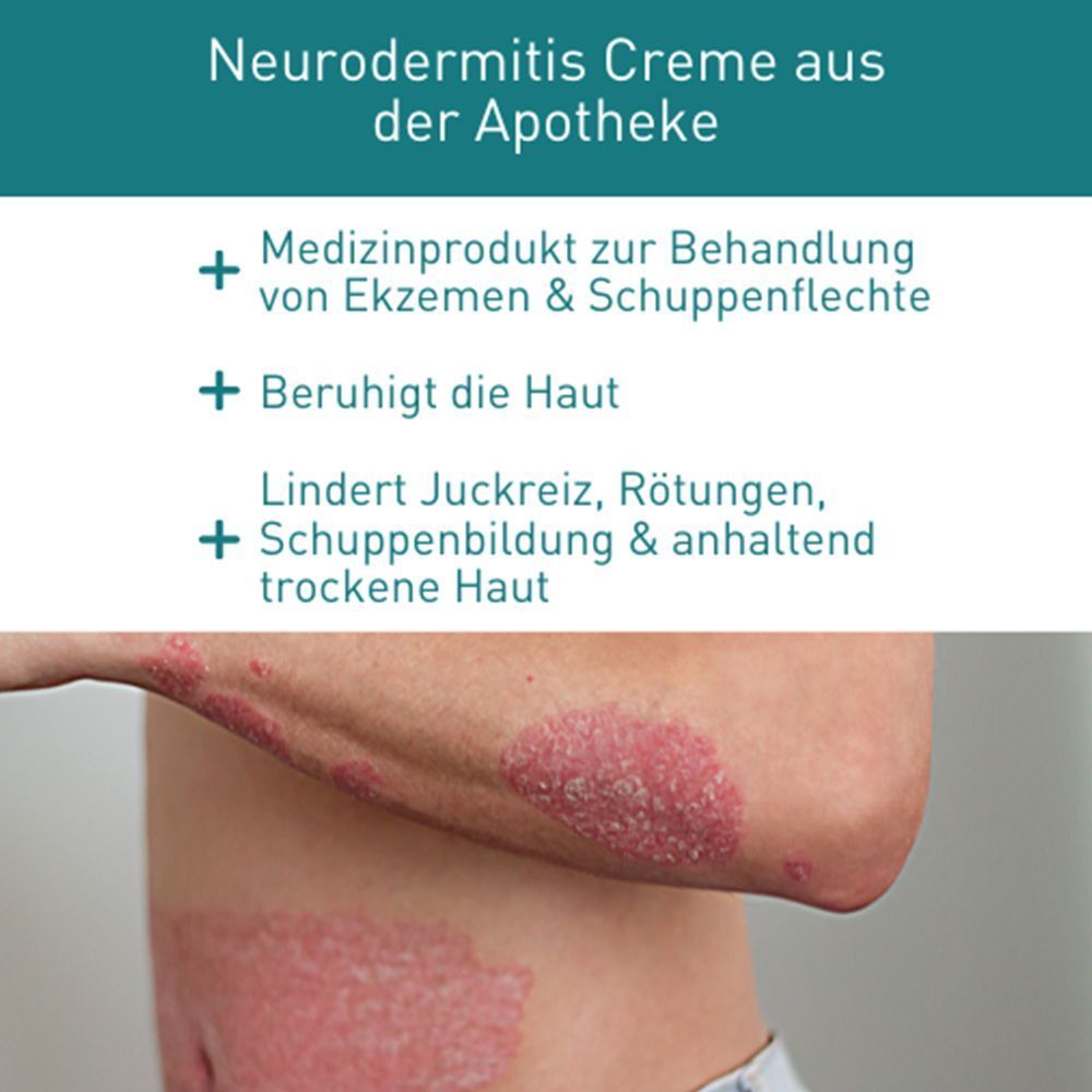 Text mit Überschrift: Neurodermitis Creme aus der Apotheke. Medizinprodukt zur Behandlung von Ekzemen & Schuppenflechte. Beruhigt die Haut.
