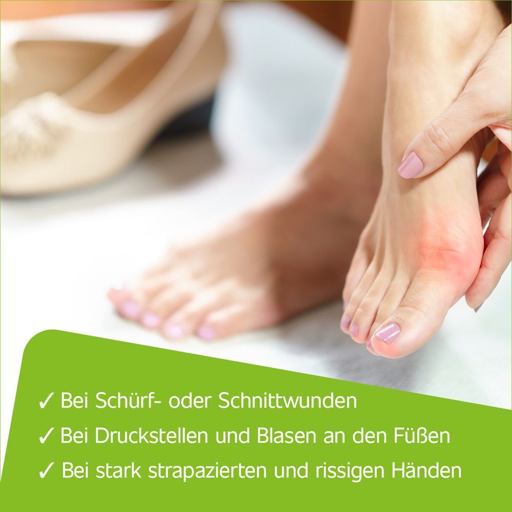 Füße mit Schürf- oder Schnittwunden, Druckstellen und rissigen Händen. Hametum Salbe.