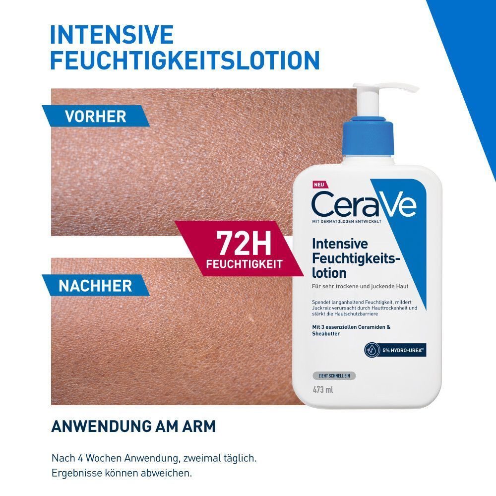 Vorher-Nachher-Bilder von trockener Haut, die mit CeraVe Intensive Feuchtigkeitslotion behandelt wurde. "72H Feuchtigkeit" ist hervorgehoben.