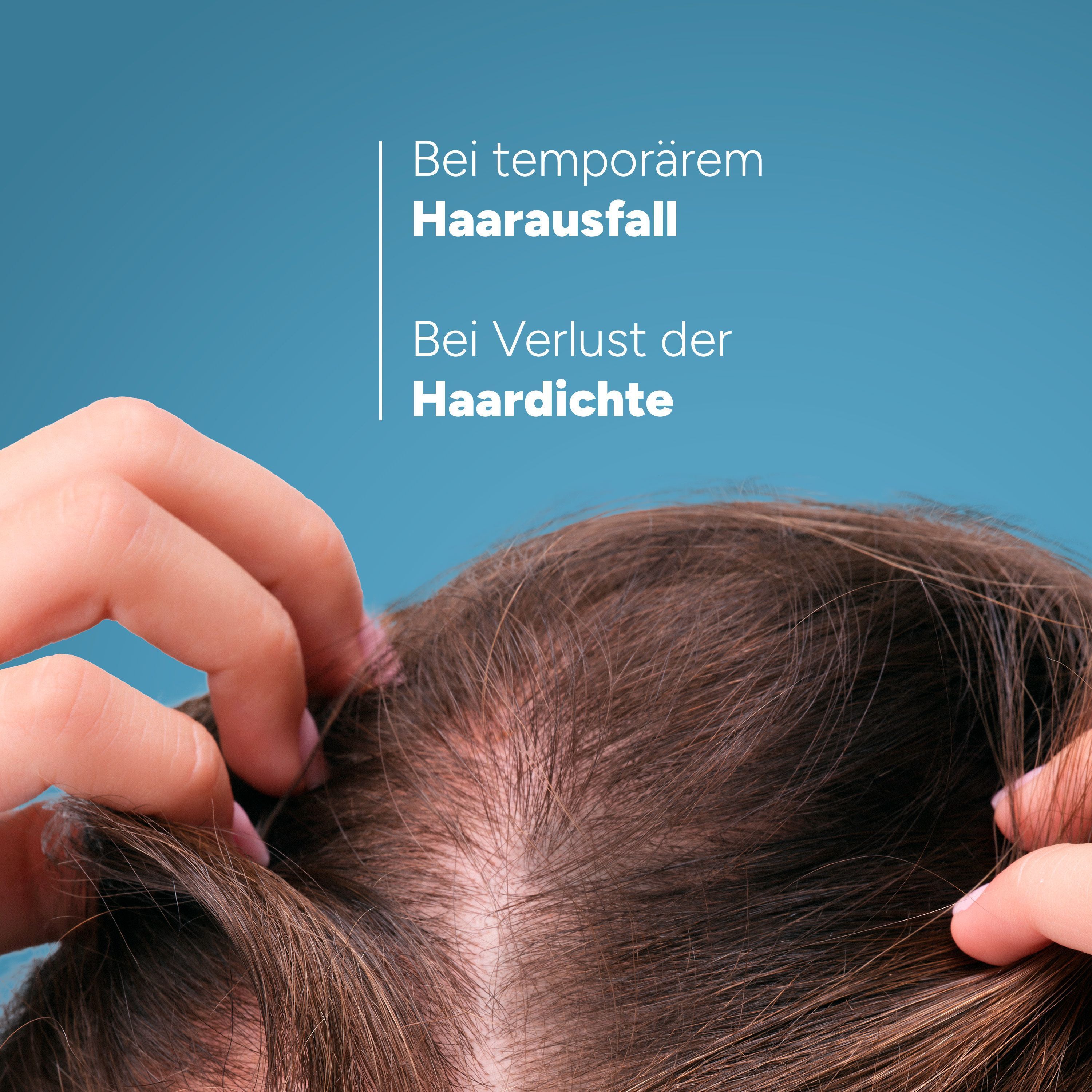 Hände, die eine Kopfhaut mit dünnem Haar untersuchen.