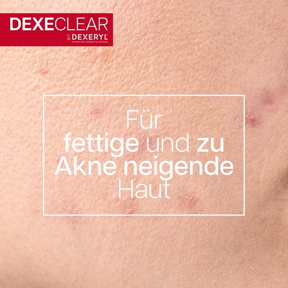 Nahaufnahme von Akne-Haut mit Text "Für fettige und zu Akne neigende Haut".
