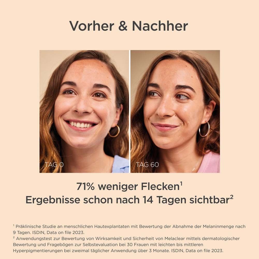 Vorher-Nachher-Vergleich von Haut mit Pigmentflecken, behandelt mit ISDIN Melaclear.